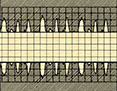 Diagram #2 - Microscopic schematic & roughness readout AFTER Flex-Honing